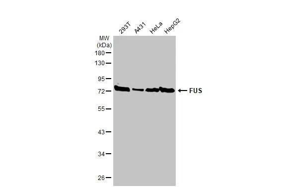 FUS Antibody in Western Blot (WB)