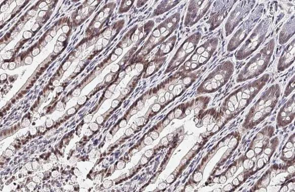 BMAL1 Antibody in Immunohistochemistry (Paraffin) (IHC (P))