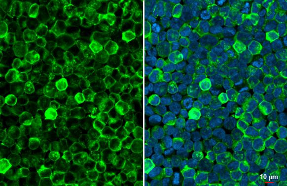 HBE1 Antibody in Immunocytochemistry (ICC/IF)