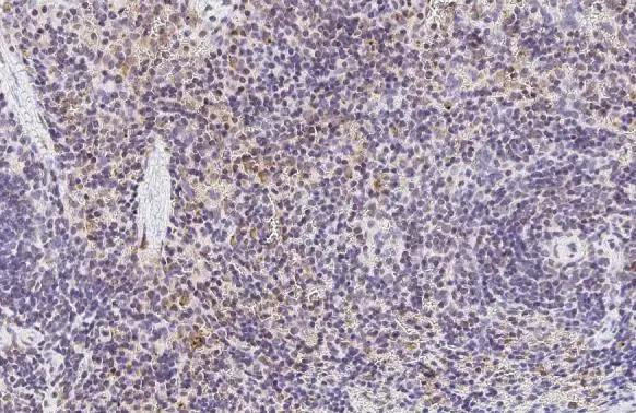 HBE1 Antibody in Immunohistochemistry (Paraffin) (IHC (P))