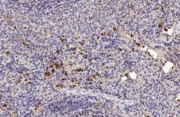 HBE1 Antibody in Immunohistochemistry (Paraffin) (IHC (P))