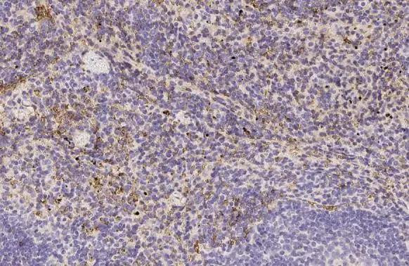 HBE1 Antibody in Immunohistochemistry (Paraffin) (IHC (P))