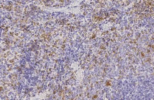 HBE1 Antibody in Immunohistochemistry (Paraffin) (IHC (P))