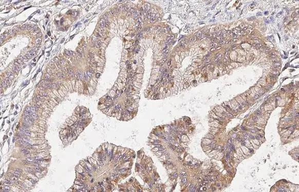 Cathepsin S Antibody in Immunohistochemistry (Paraffin) (IHC (P))