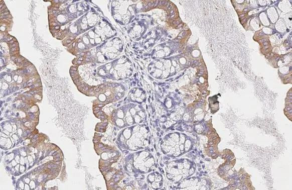 SMYD3 Antibody in Immunohistochemistry (Paraffin) (IHC (P))