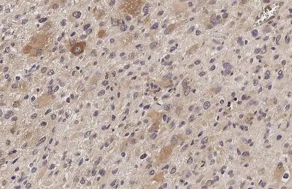 IFIT3 Antibody in Immunohistochemistry (Paraffin) (IHC (P))