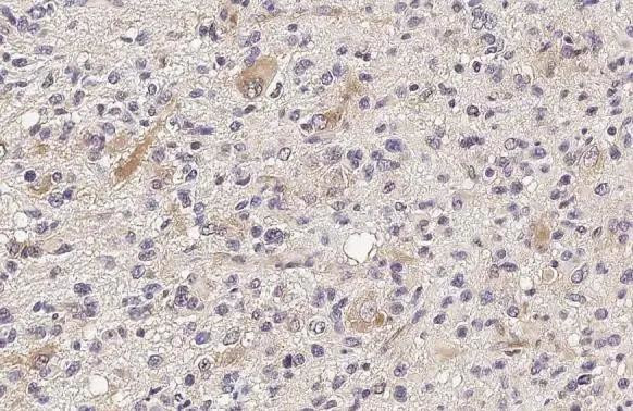 IFIT3 Antibody in Immunohistochemistry (Paraffin) (IHC (P))