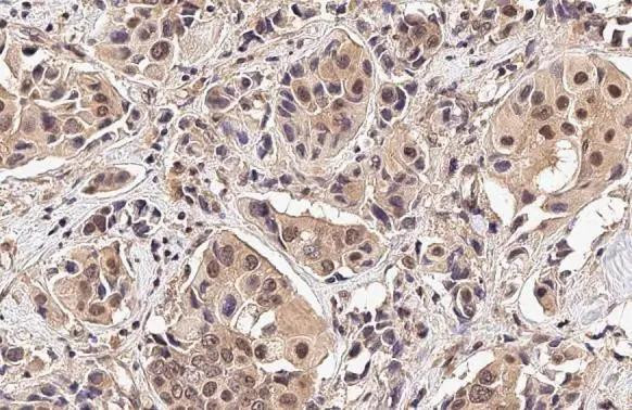 PIN1 Antibody in Immunohistochemistry (Paraffin) (IHC (P))