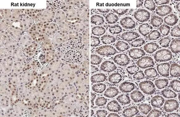 PIN1 Antibody in Immunohistochemistry (Paraffin) (IHC (P))