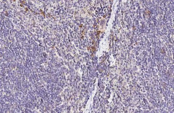 CCR4 Antibody in Immunohistochemistry (Paraffin) (IHC (P))