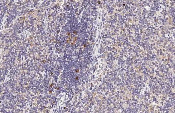 CCR4 Antibody in Immunohistochemistry (Paraffin) (IHC (P))