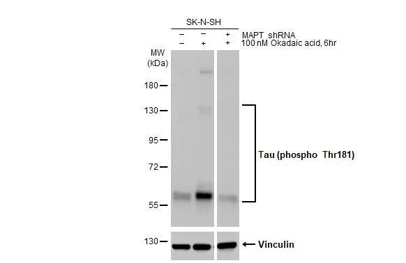 Phospho-Tau (Thr181) Antibody in Western Blot (WB)