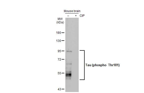 Phospho-Tau (Thr181) Antibody in Western Blot (WB)