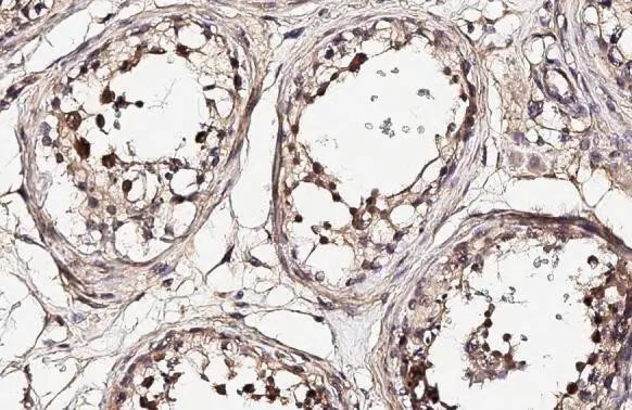 NEK2 Antibody in Immunohistochemistry (Paraffin) (IHC (P))