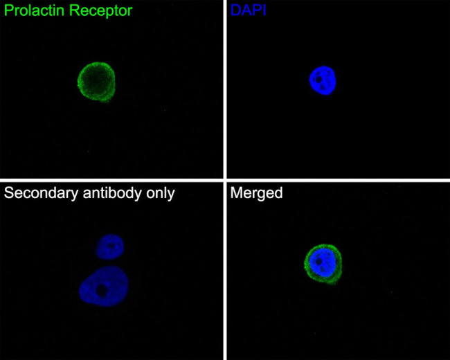 Prolactin Receptor Antibody in Immunocytochemistry (ICC/IF)