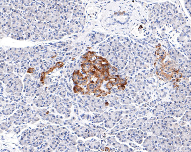 Prolactin Receptor Antibody in Immunohistochemistry (Paraffin) (IHC (P))