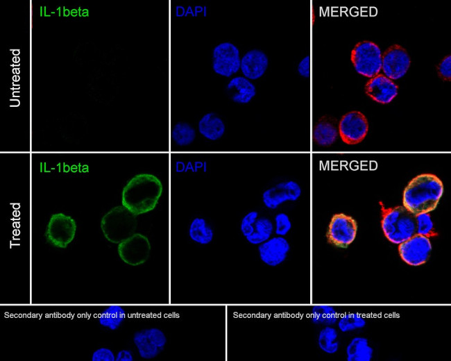 IL-1 beta Antibody in Immunocytochemistry (ICC/IF)