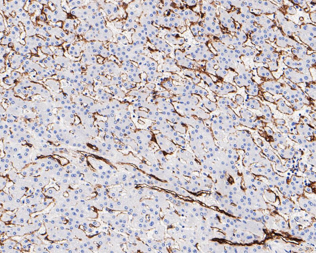 Caveolin 1 Antibody in Immunohistochemistry (Paraffin) (IHC (P))