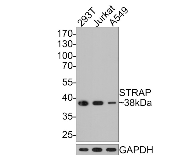 STRAP Antibody in Western Blot (WB)