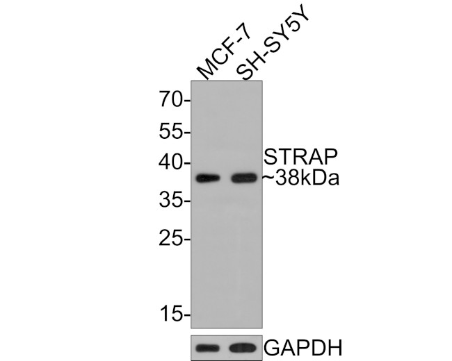 STRAP Antibody in Western Blot (WB)