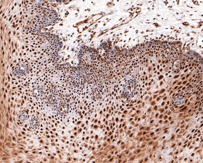 BRCA1 Antibody in Immunohistochemistry (Paraffin) (IHC (P))