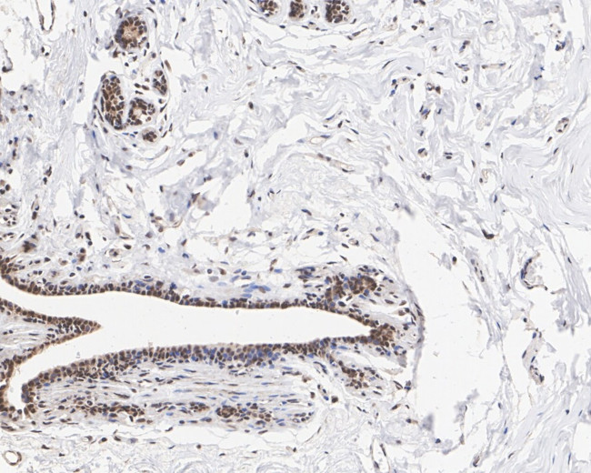 BRCA1 Antibody in Immunohistochemistry (Paraffin) (IHC (P))