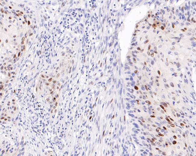 p21 Antibody in Immunohistochemistry (Paraffin) (IHC (P))