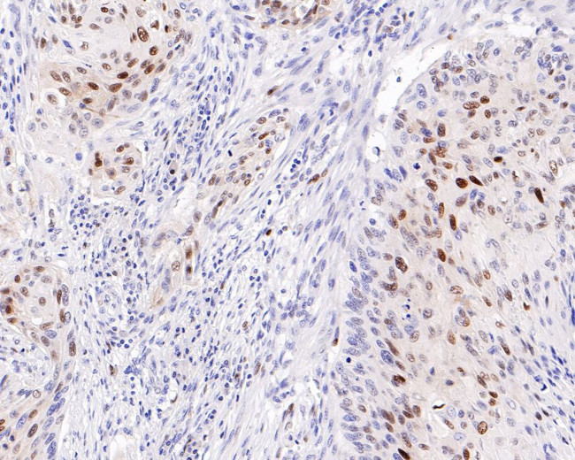 p21 Antibody in Immunohistochemistry (Paraffin) (IHC (P))