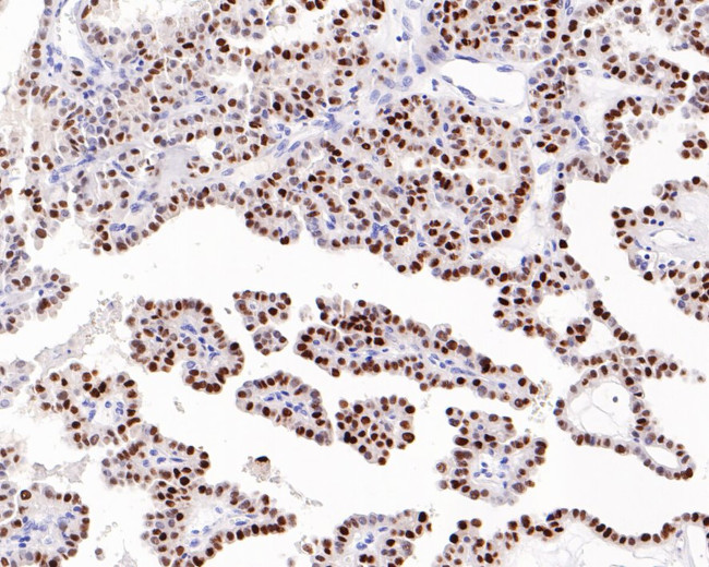 p21 Antibody in Immunohistochemistry (Paraffin) (IHC (P))