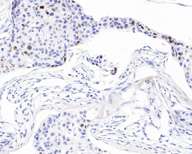 p21 Antibody in Immunohistochemistry (Paraffin) (IHC (P))