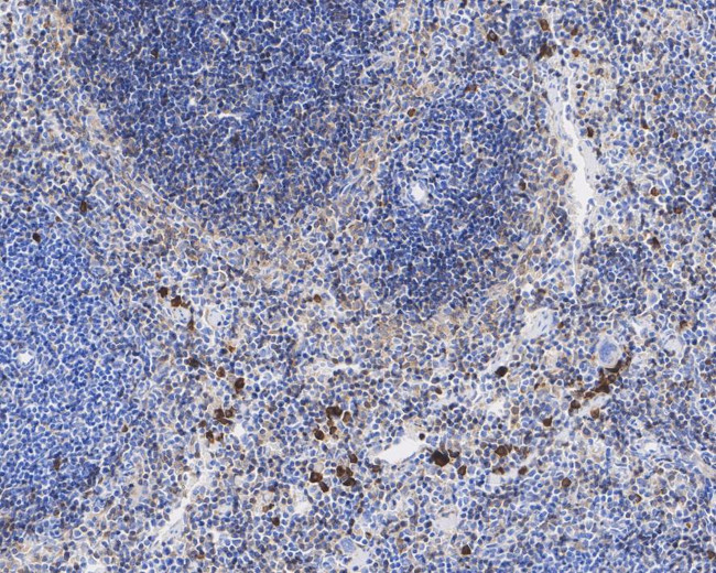 CD42a Antibody in Immunohistochemistry (Paraffin) (IHC (P))