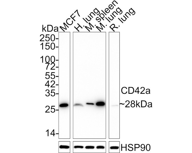 CD42a Antibody in Western Blot (WB)