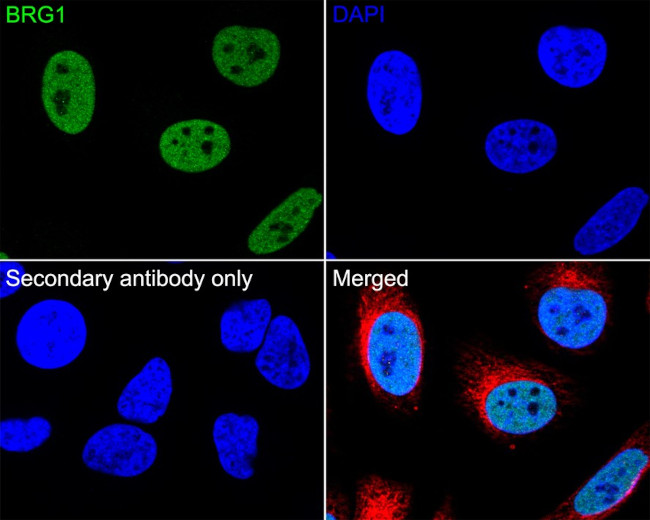 BRG1 Antibody in Immunohistochemistry (Paraffin) (IHC (P))