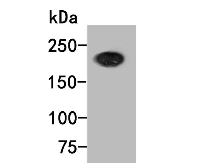 BRG1 Antibody in Western Blot (WB)