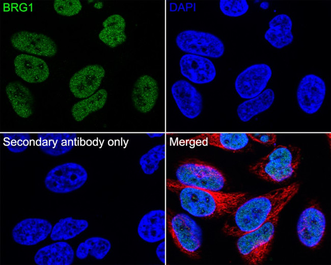 BRG1 Antibody in Immunohistochemistry (Paraffin) (IHC (P))