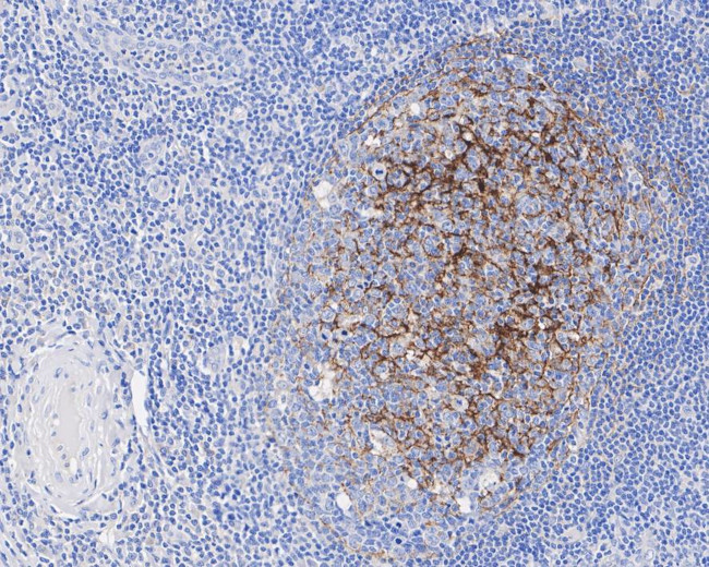 CD35 Antibody in Immunohistochemistry (Paraffin) (IHC (P))