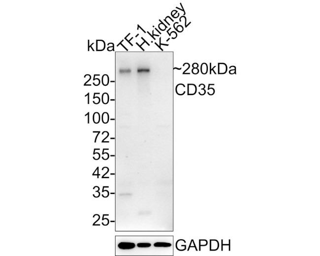 CD35 Antibody in Western Blot (WB)
