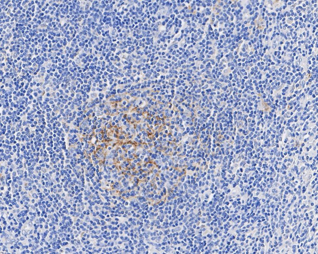 CD35 Antibody in Immunohistochemistry (Paraffin) (IHC (P))