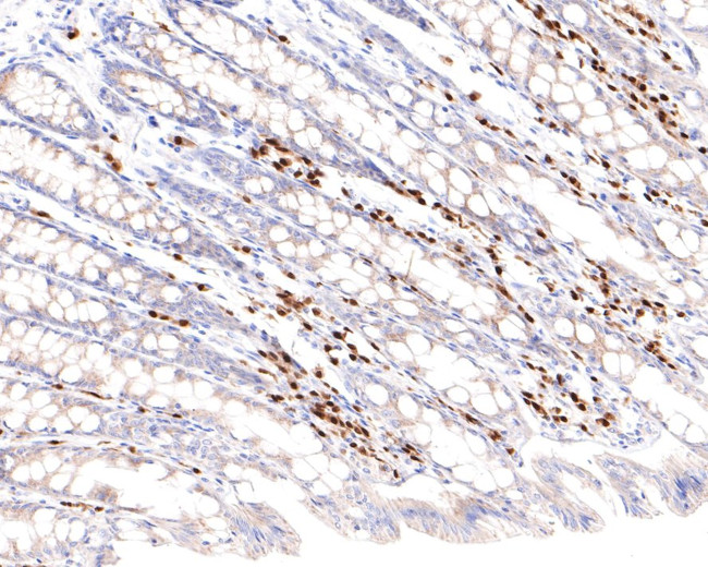 MUM1 Antibody in Immunohistochemistry (Paraffin) (IHC (P))