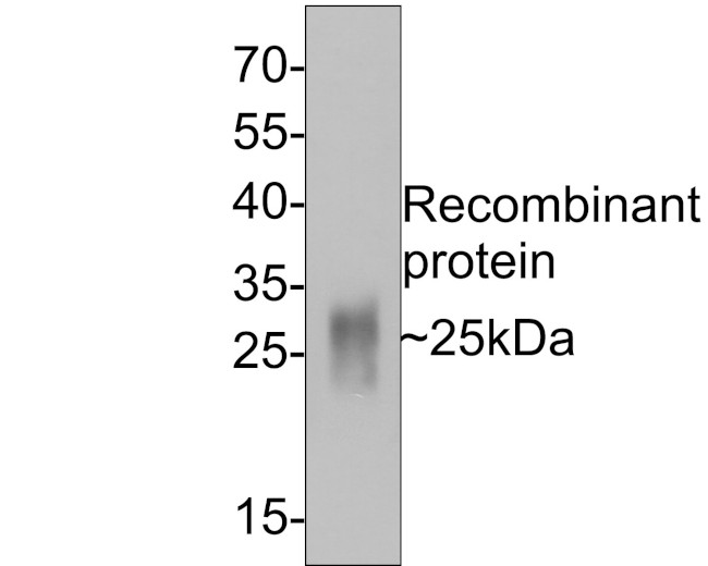 GM-CSF Antibody in Western Blot (WB)