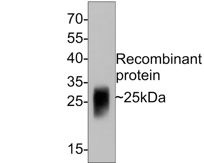 GM-CSF Antibody in Western Blot (WB)