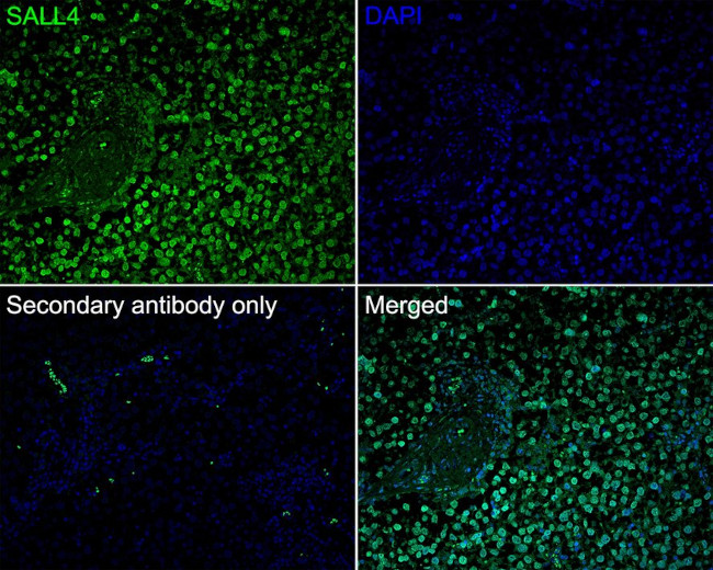 SALL4 Antibody in Immunohistochemistry (Paraffin) (IHC (P))