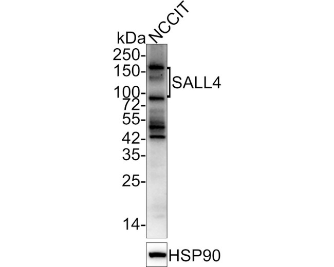 SALL4 Antibody in Western Blot (WB)