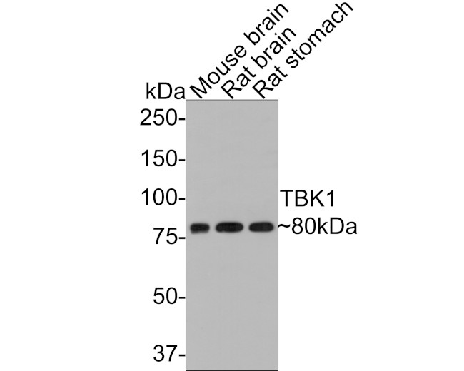 TBK1 Antibody in Western Blot (WB)