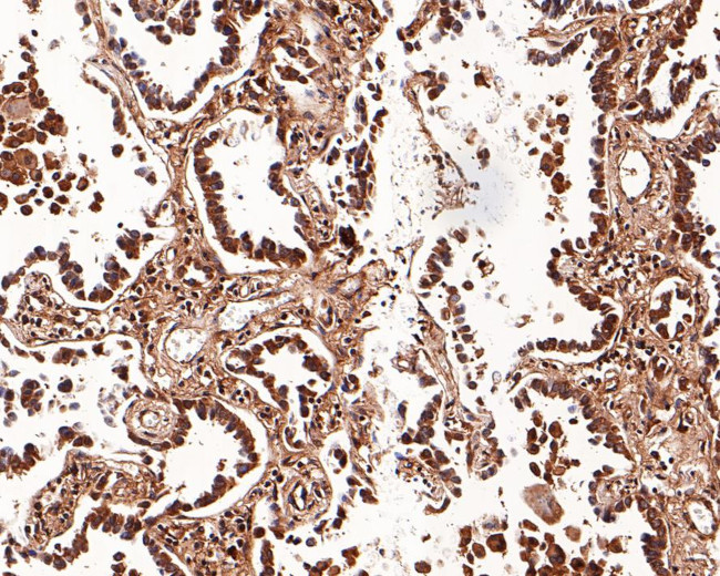 K-Ras Antibody in Immunohistochemistry (Paraffin) (IHC (P))