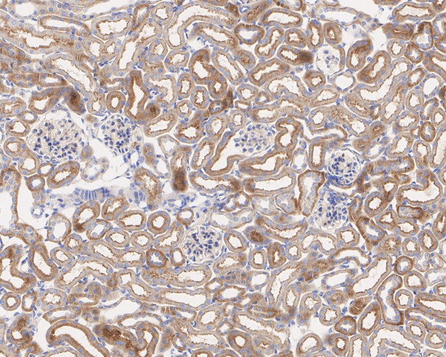 K-Ras Antibody in Immunohistochemistry (Paraffin) (IHC (P))