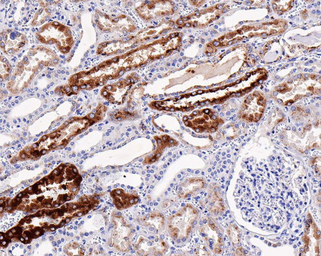 NAPSA Antibody in Immunohistochemistry (Paraffin) (IHC (P))