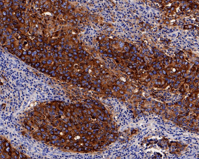 NAPSA Antibody in Immunohistochemistry (Paraffin) (IHC (P))