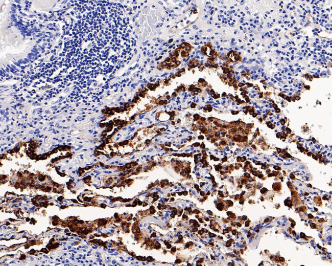 NAPSA Antibody in Immunohistochemistry (Paraffin) (IHC (P))