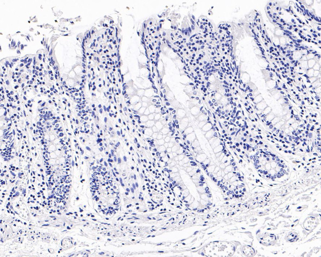 NAPSA Antibody in Immunohistochemistry (Paraffin) (IHC (P))